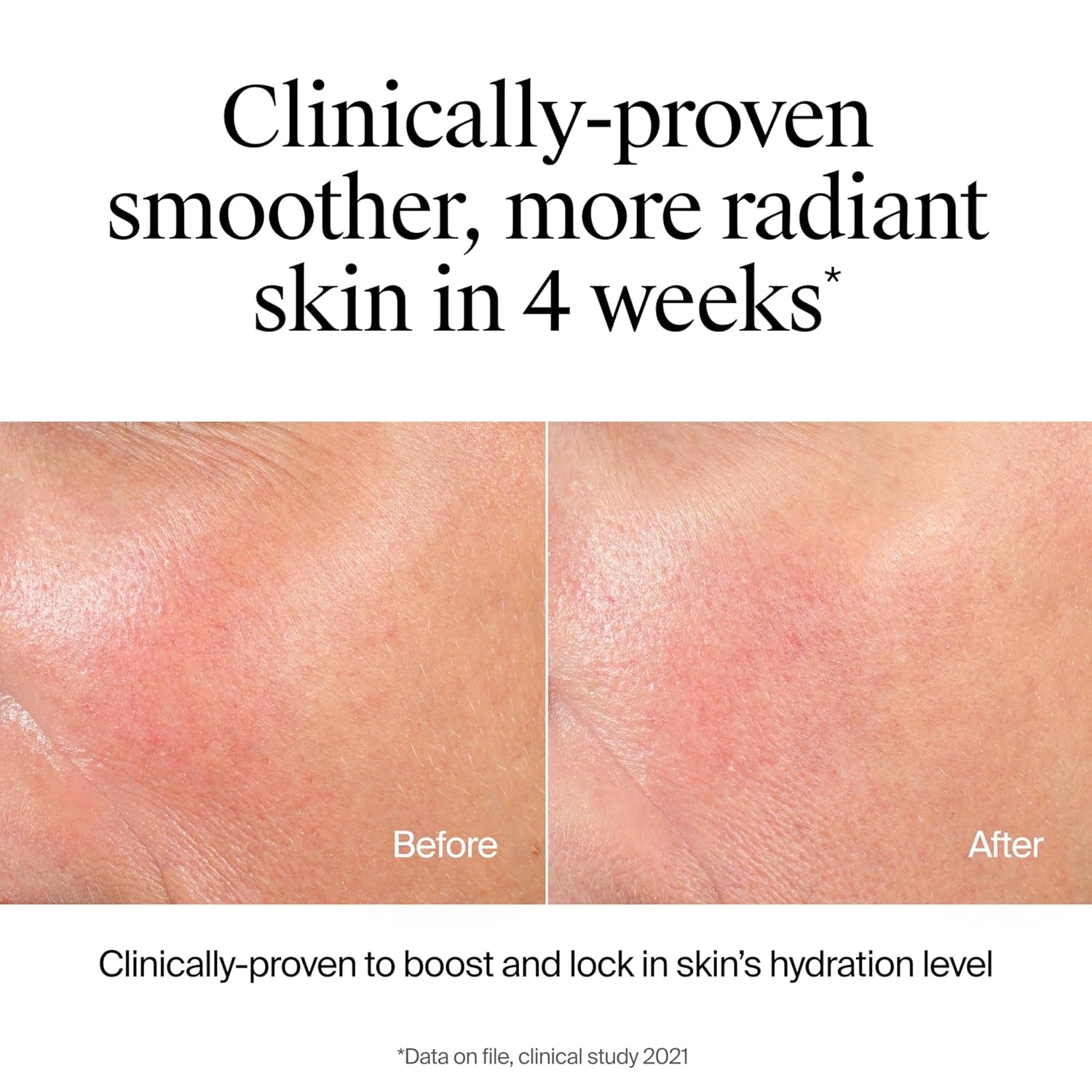 Neutrogena Hydro Boost Hydrating Facial Cleanser and Makeup Remover Gel with Hyaluronic Acid, Moisture-Locking Formula for Soft Skin, Hypoallergenic, Oil-Free, Soap-Free, 7.8 Fl Oz