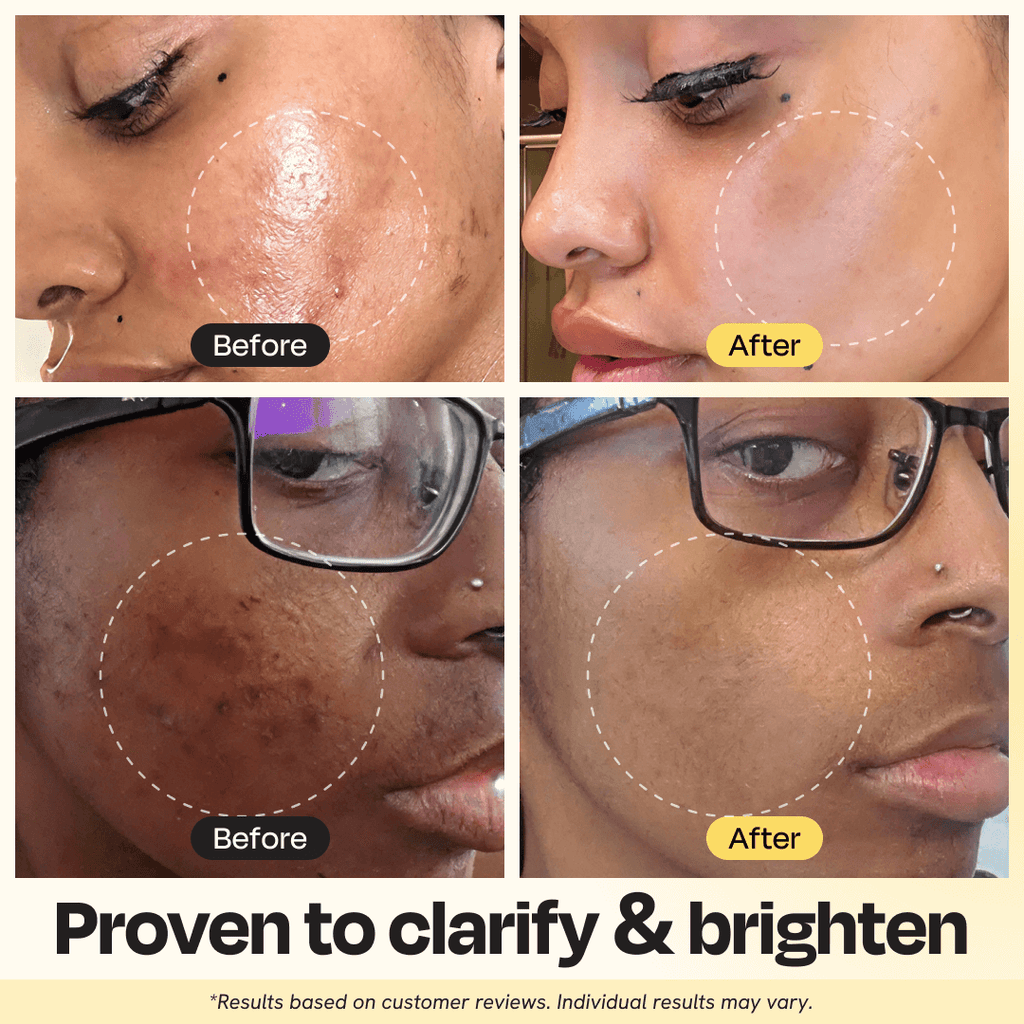 Vitamin C Clay Mask – Brightening & Detoxifying Face Mask