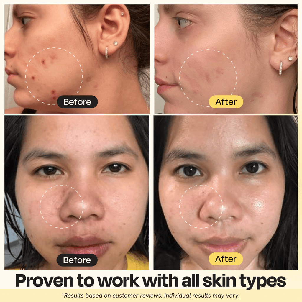 Vitamin C Clay Mask – Brightening & Detoxifying Face Mask