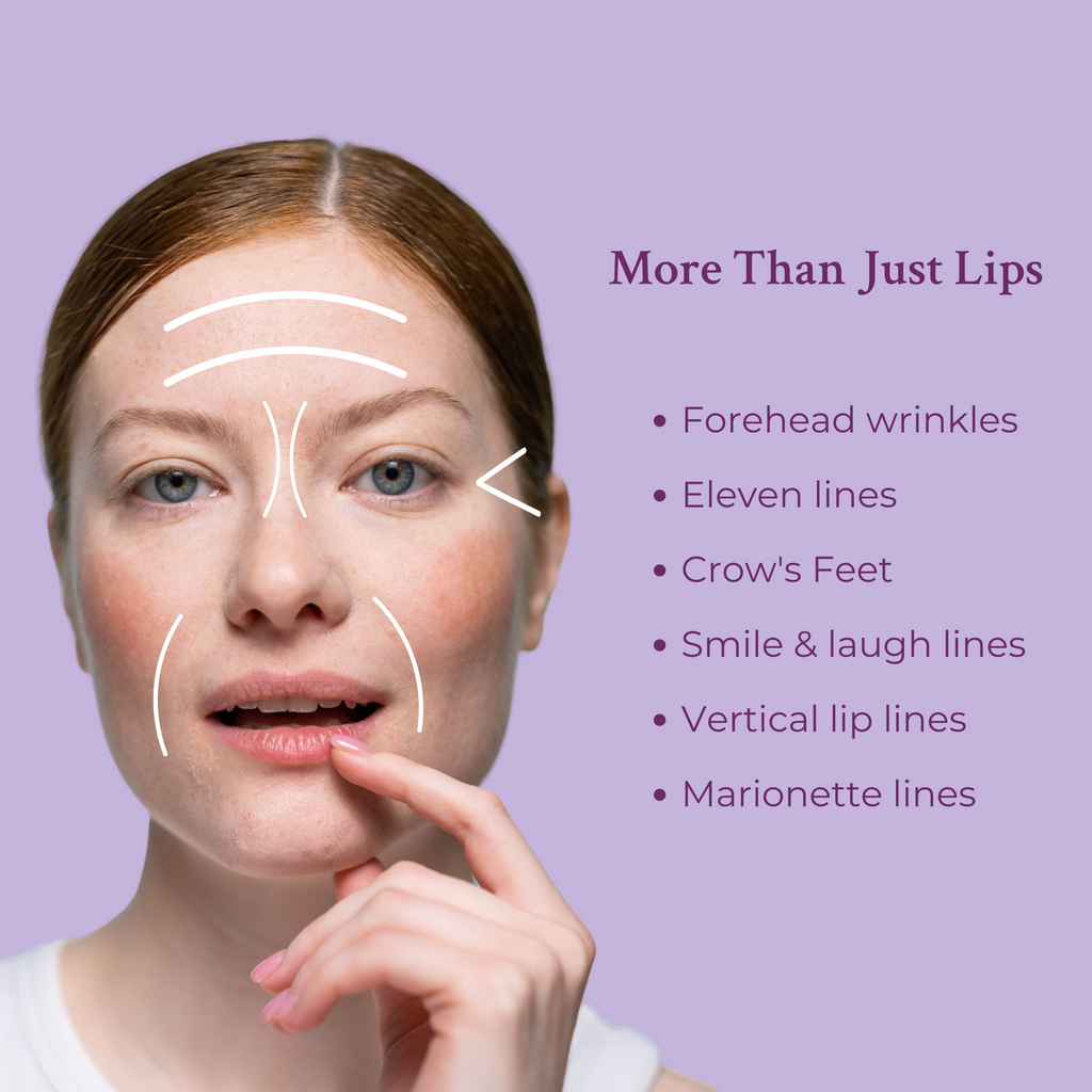 Ageless Lip & Line Filler – Plump Lips & Smooth Fine Lines