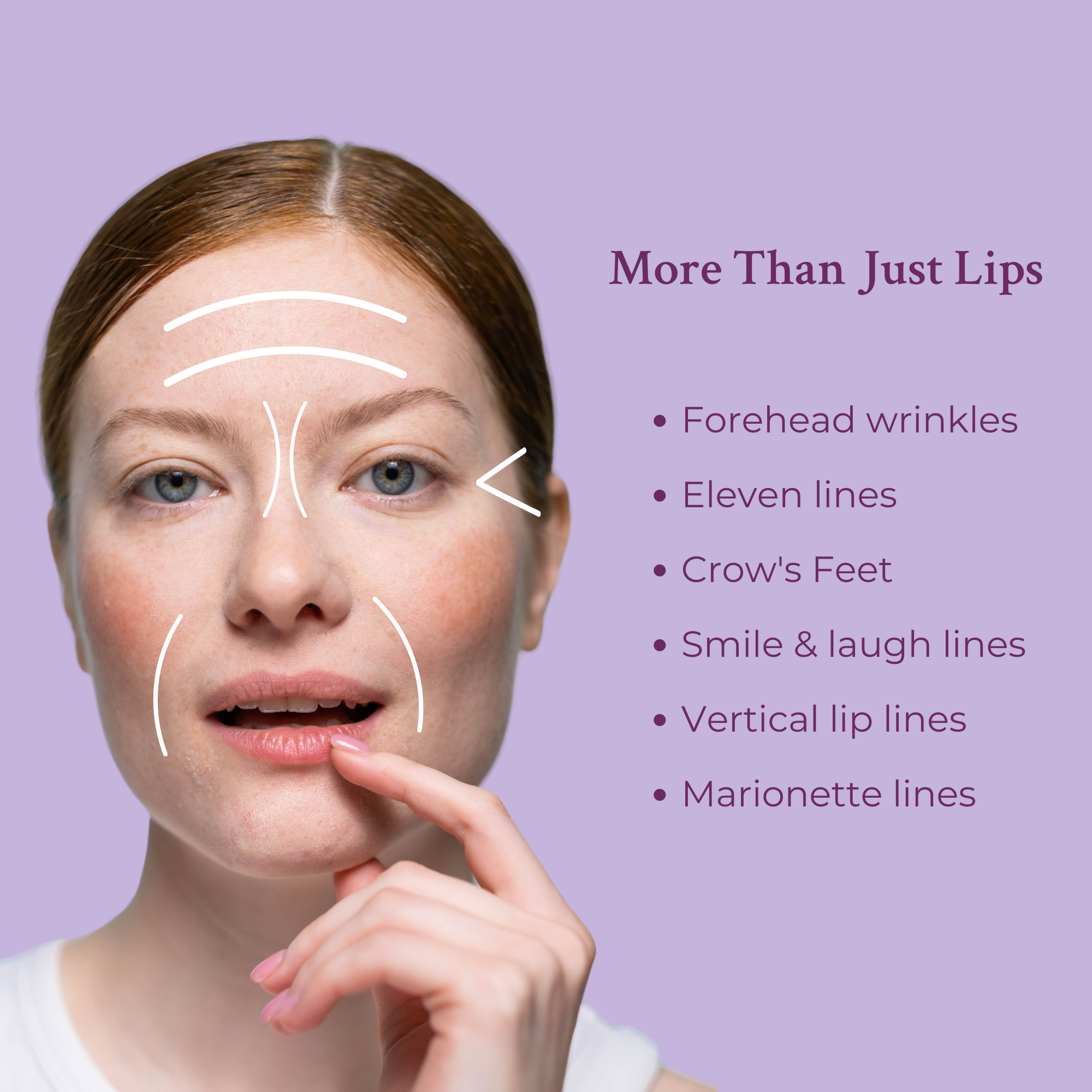 Ageless Lip & Line Filler – Plump Lips & Smooth Fine Lines