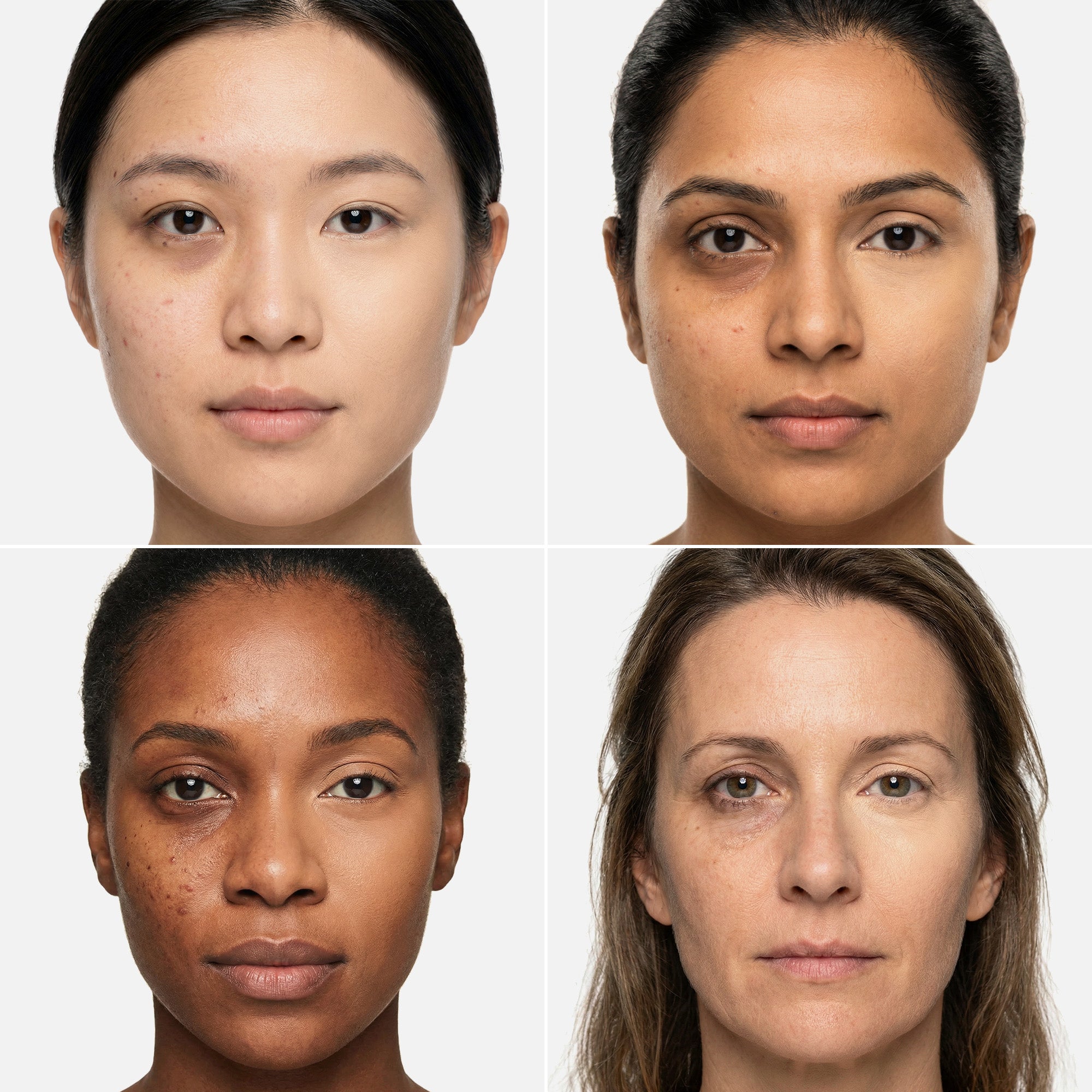 AMAZINGCONCEALER – Full Coverage Concealer for All Skin Tones